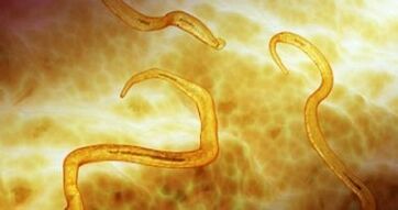 pinworm paraziti u ljudskom tijelu