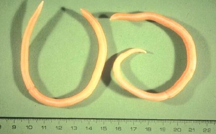 pinworm iz ljudskog tijela