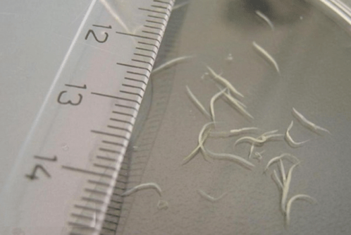 kako ukloniti pinworms iz djeteta