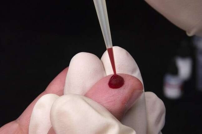 uzimanje krvi za analizu na parazite