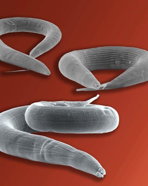 parazit pinworm koji živi u crijevima