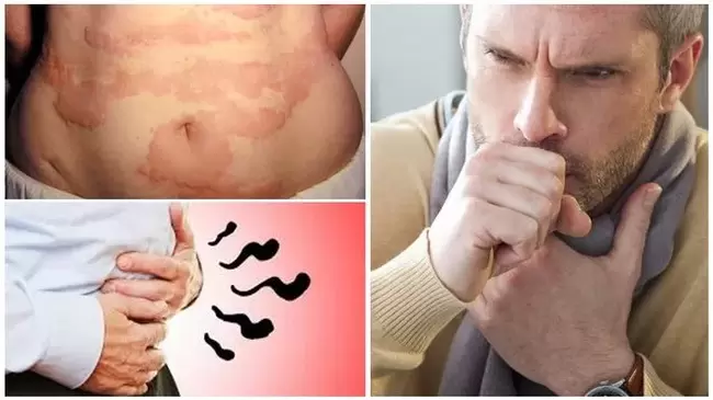 Alergije, kašalj i nadutost znakovi su oštećenja organizma od strane crva