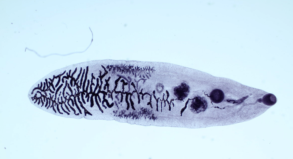 Parazit iz klase metilja (trematoda)