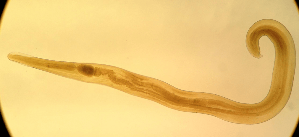 Pinworm je čest parazit među djecom. 